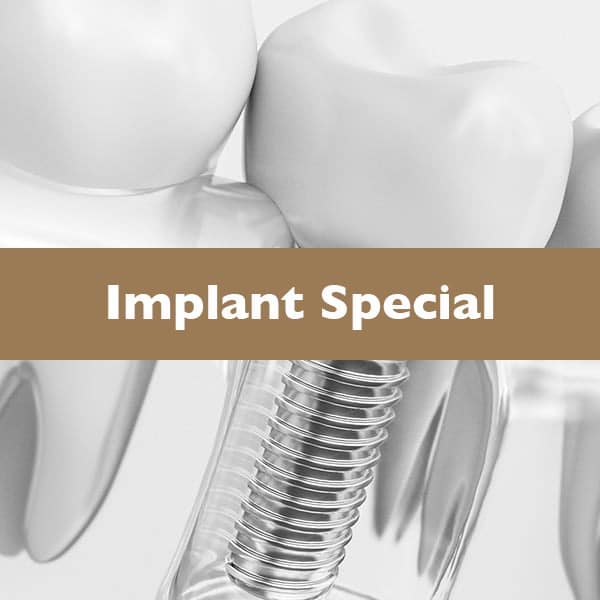 Implant special card
